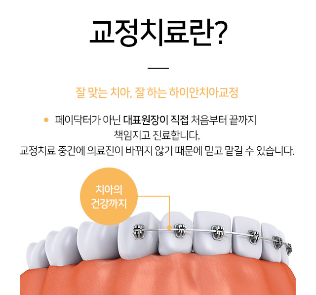 Chungmuro Orthodontics and various orthodontic treatments are available Chungmuro Orthodontics and various orthodontic treatments are available
